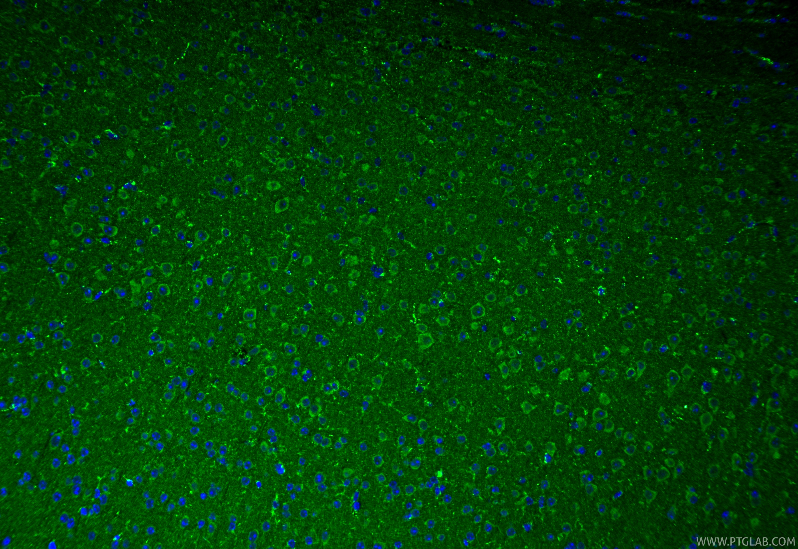 Immunofluorescence (IF) / fluorescent staining of mouse brain tissue using SQRDL Polyclonal antibody (17256-1-AP)