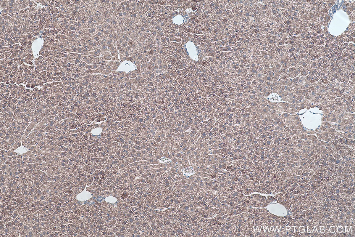 Immunohistochemistry (IHC) staining of mouse liver tissue using SQRDL Polyclonal antibody (17256-1-AP)
