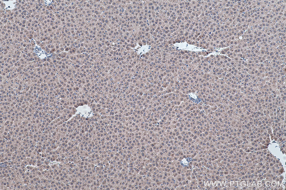 Immunohistochemistry (IHC) staining of rat liver tissue using SQRDL Polyclonal antibody (17256-1-AP)