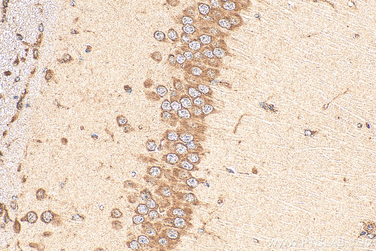 Immunohistochemistry (IHC) staining of mouse brain tissue using SQRDL Polyclonal antibody (17256-1-AP)