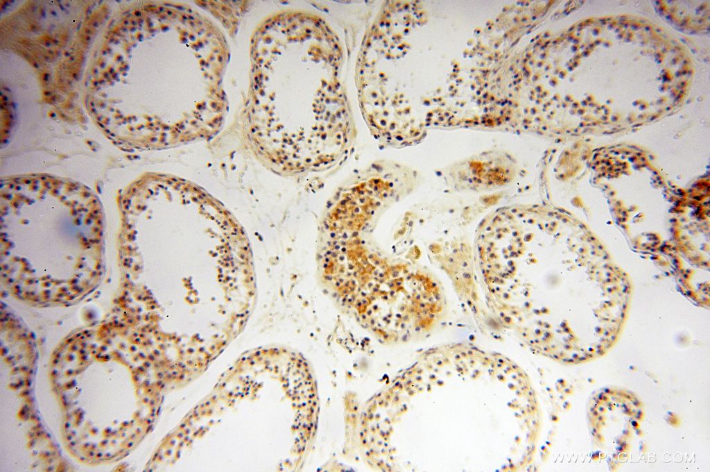 Immunohistochemistry (IHC) staining of human testis tissue using SQRDL Polyclonal antibody (17256-1-AP)