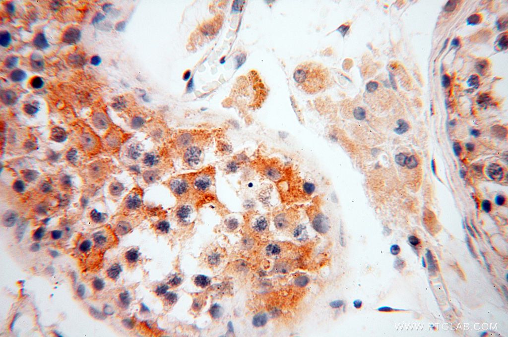 Immunohistochemistry (IHC) staining of human testis tissue using SQRDL Polyclonal antibody (17256-1-AP)