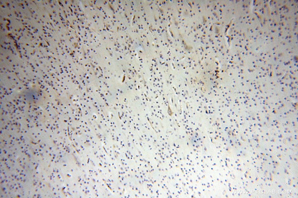 Immunohistochemistry (IHC) staining of human brain tissue using SQRDL Polyclonal antibody (17256-1-AP)