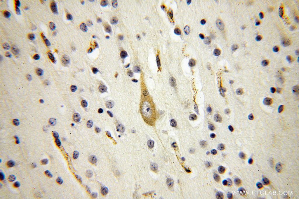Immunohistochemistry (IHC) staining of human brain tissue using SQRDL Polyclonal antibody (17256-1-AP)