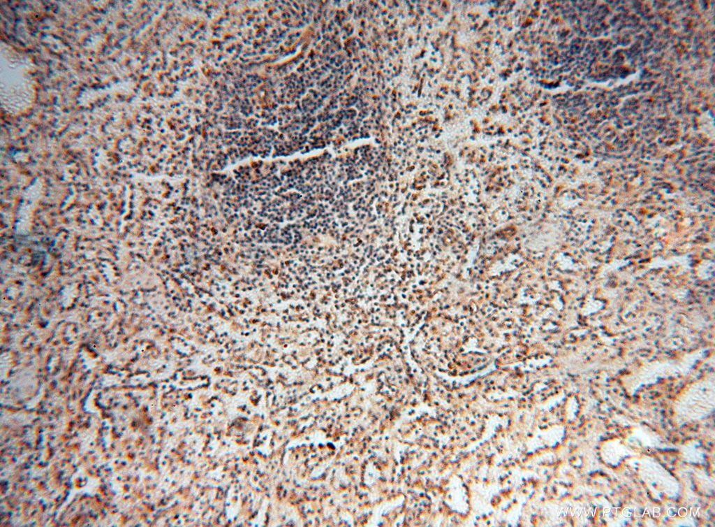 Immunohistochemistry (IHC) staining of human spleen tissue using SQRDL Polyclonal antibody (17256-1-AP)