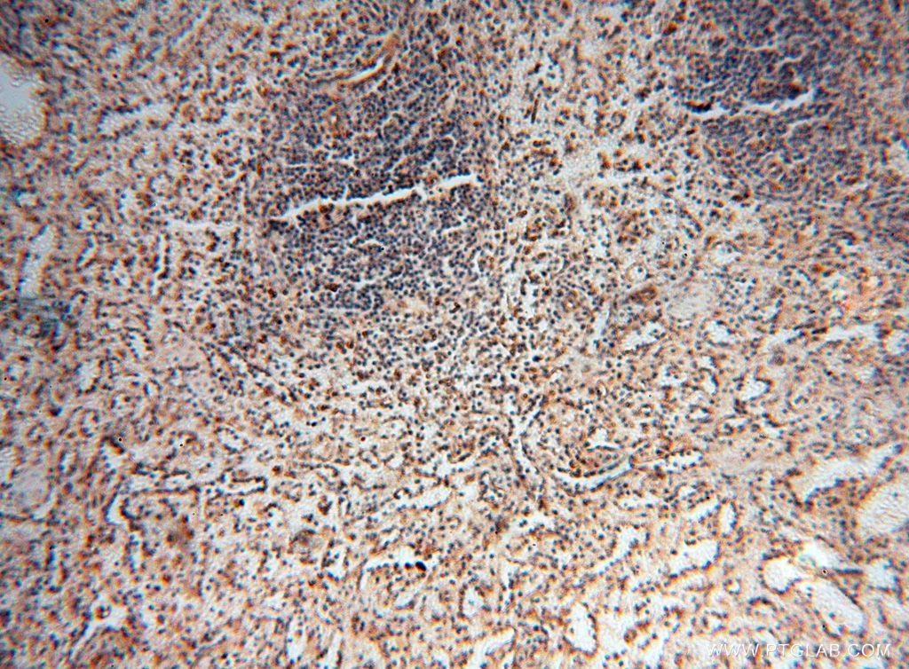 IHC staining of human spleen using 17256-1-AP