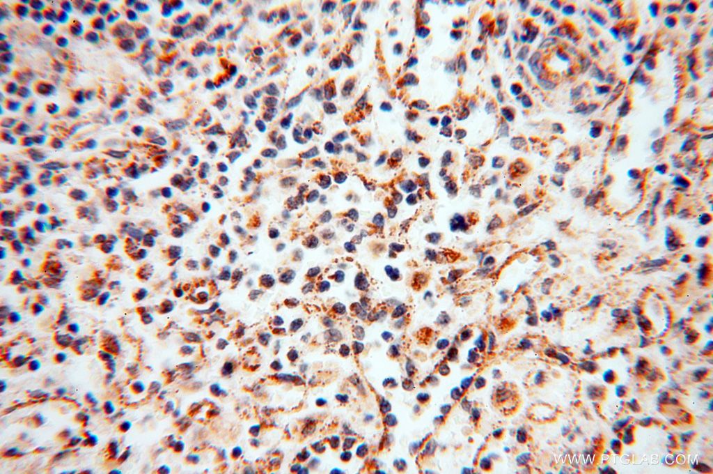 Immunohistochemistry (IHC) staining of human spleen tissue using SQRDL Polyclonal antibody (17256-1-AP)