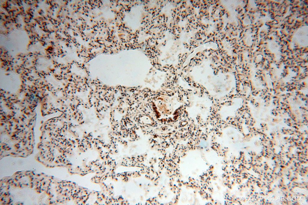 IHC staining of human lung using 17256-1-AP