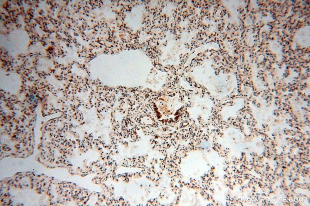 Immunohistochemistry (IHC) staining of human lung tissue using SQRDL Polyclonal antibody (17256-1-AP)