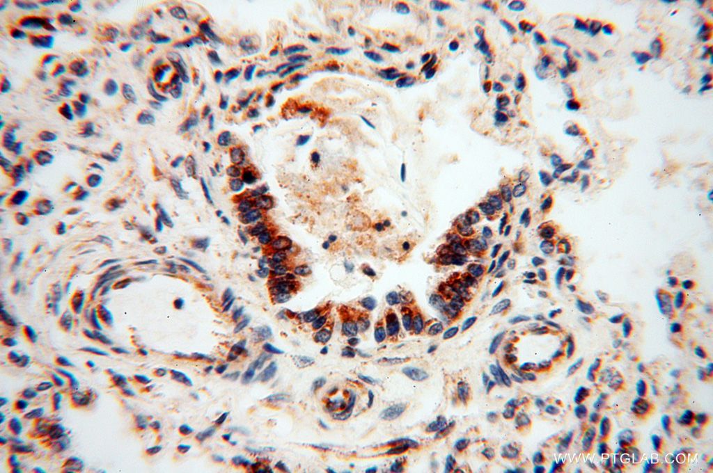 Immunohistochemistry (IHC) staining of human lung tissue using SQRDL Polyclonal antibody (17256-1-AP)