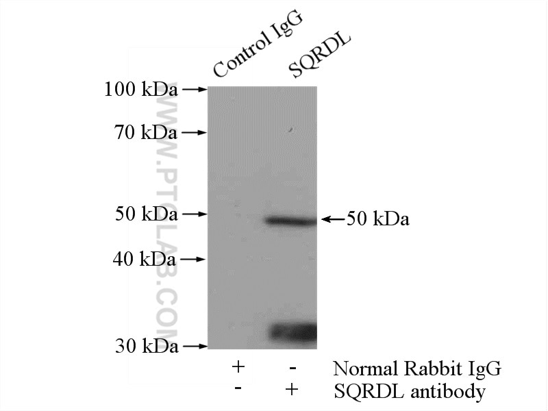 Immunoprecipitation (IP) experiment of HeLa cells using SQRDL Polyclonal antibody (17256-1-AP)