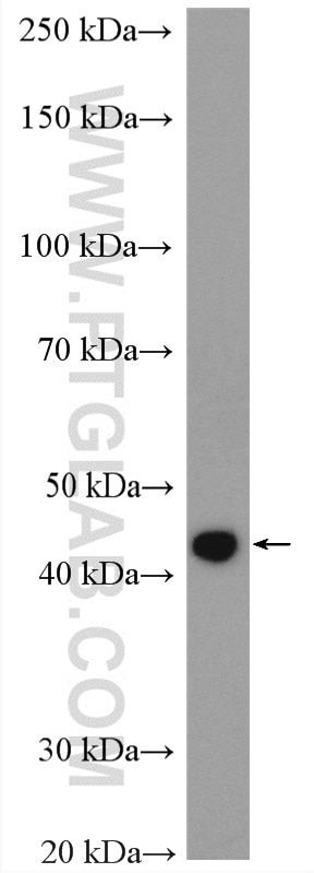 Western Blot (WB) analysis of HeLa cells using SQRDL Polyclonal antibody (17256-1-AP)
