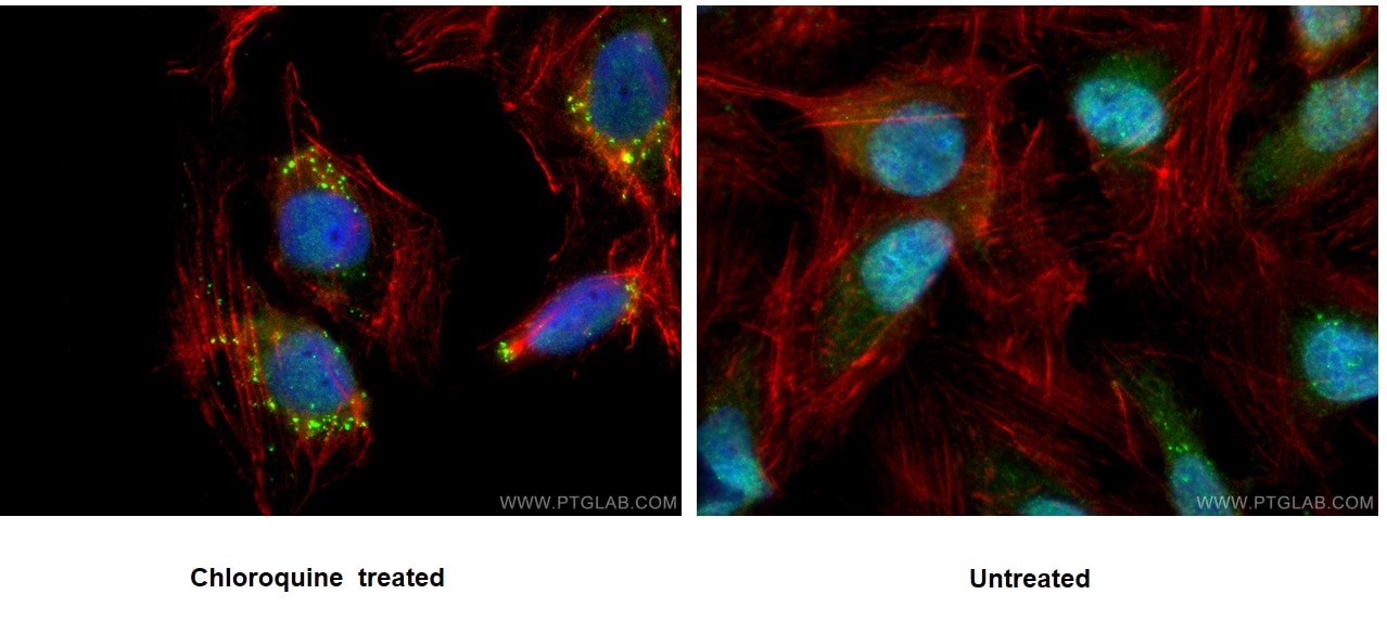 Immunofluorescence (IF) / fluorescent staining of U2OS cells using P62,SQSTM1 Polyclonal antibody (18420-1-AP)