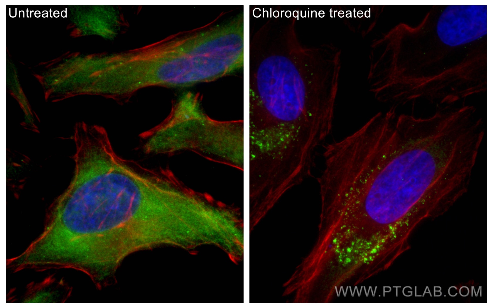 Immunofluorescence (IF) / fluorescent staining of HeLa cells using P62,SQSTM1 Polyclonal antibody (18420-1-AP)