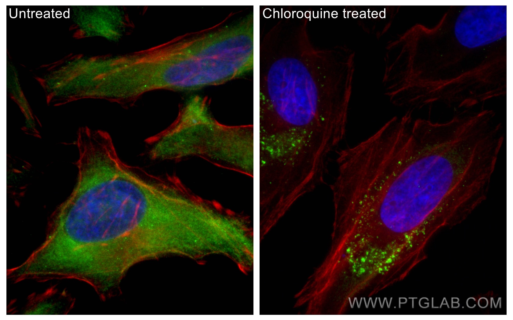 IF Staining of HeLa using 18420-1-AP