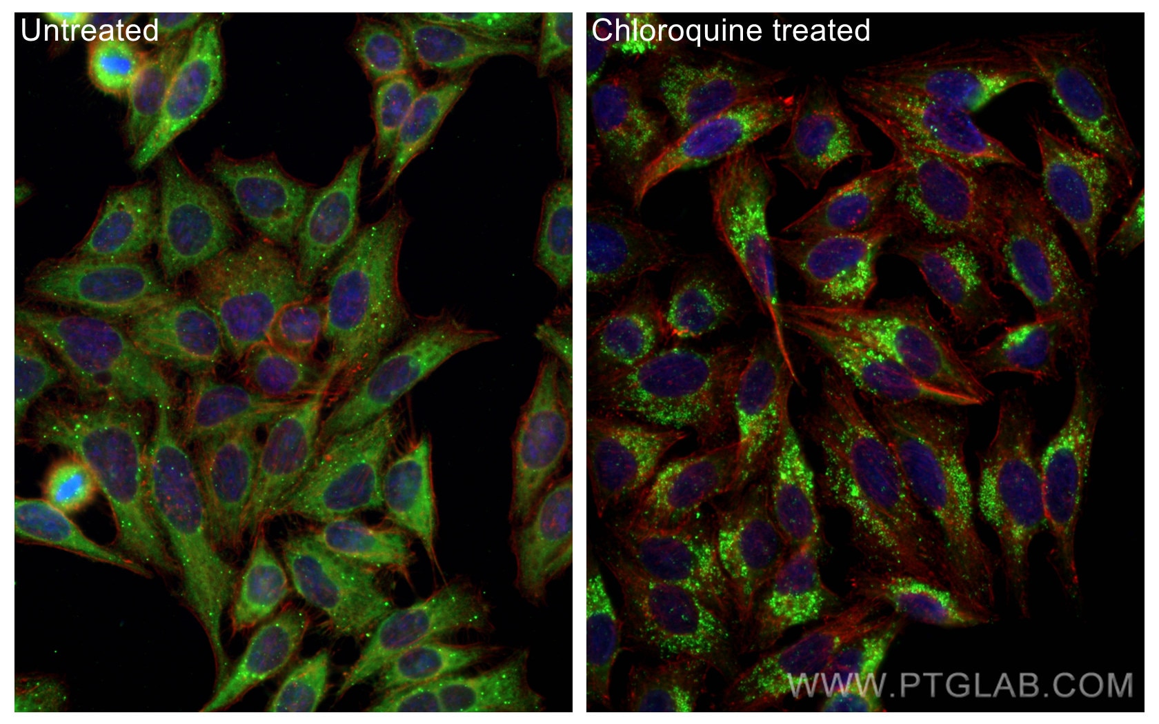 Immunofluorescence (IF) / fluorescent staining of HepG2 cells using P62,SQSTM1 Polyclonal antibody (18420-1-AP)