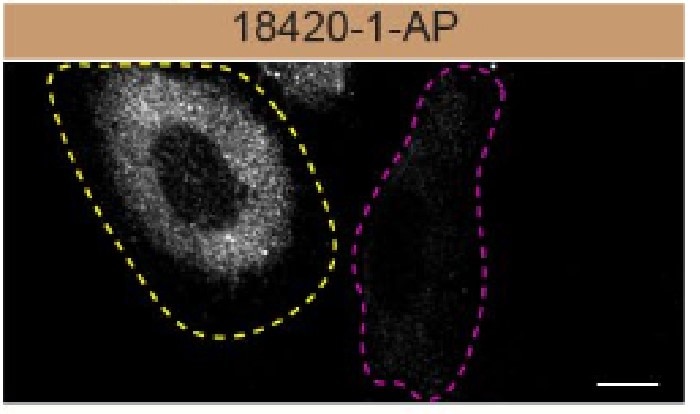 Immunofluorescence (IF) / fluorescent staining of U2OS cells using P62,SQSTM1 Polyclonal antibody (18420-1-AP)