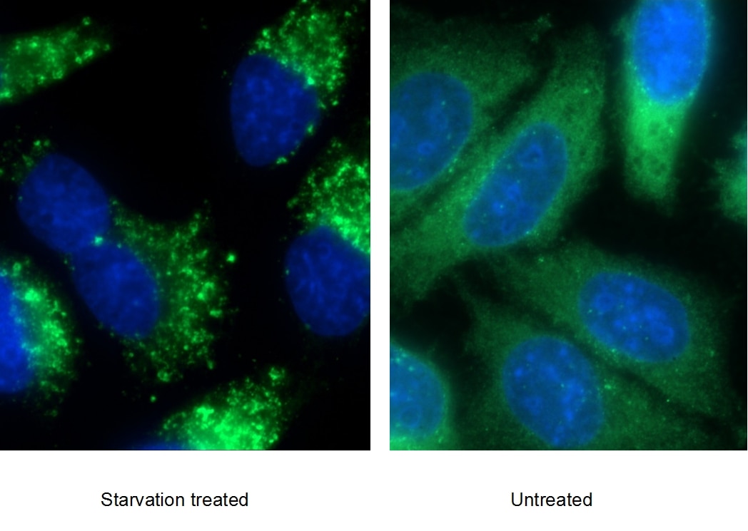 Immunofluorescence (IF) / fluorescent staining of HepG2 cells using P62,SQSTM1 Polyclonal antibody (18420-1-AP)