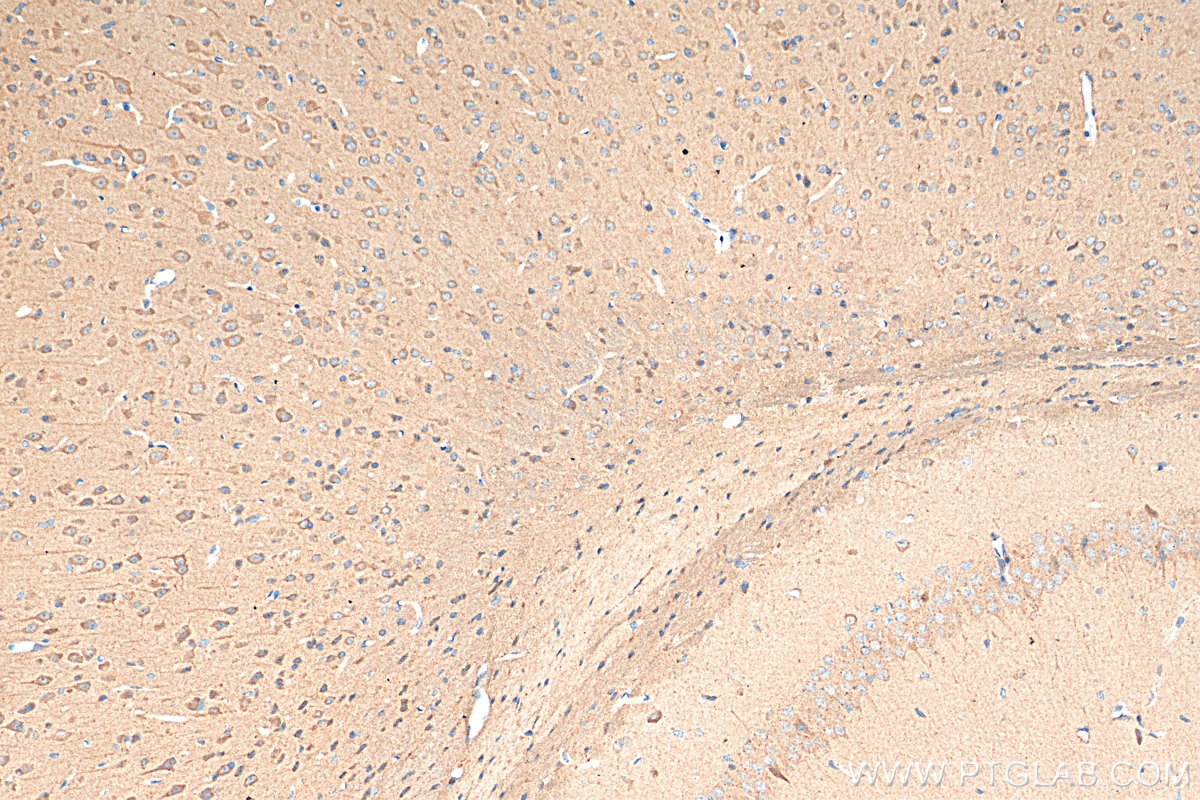 Immunohistochemistry (IHC) staining of mouse brain tissue using P62,SQSTM1 Polyclonal antibody (18420-1-AP)