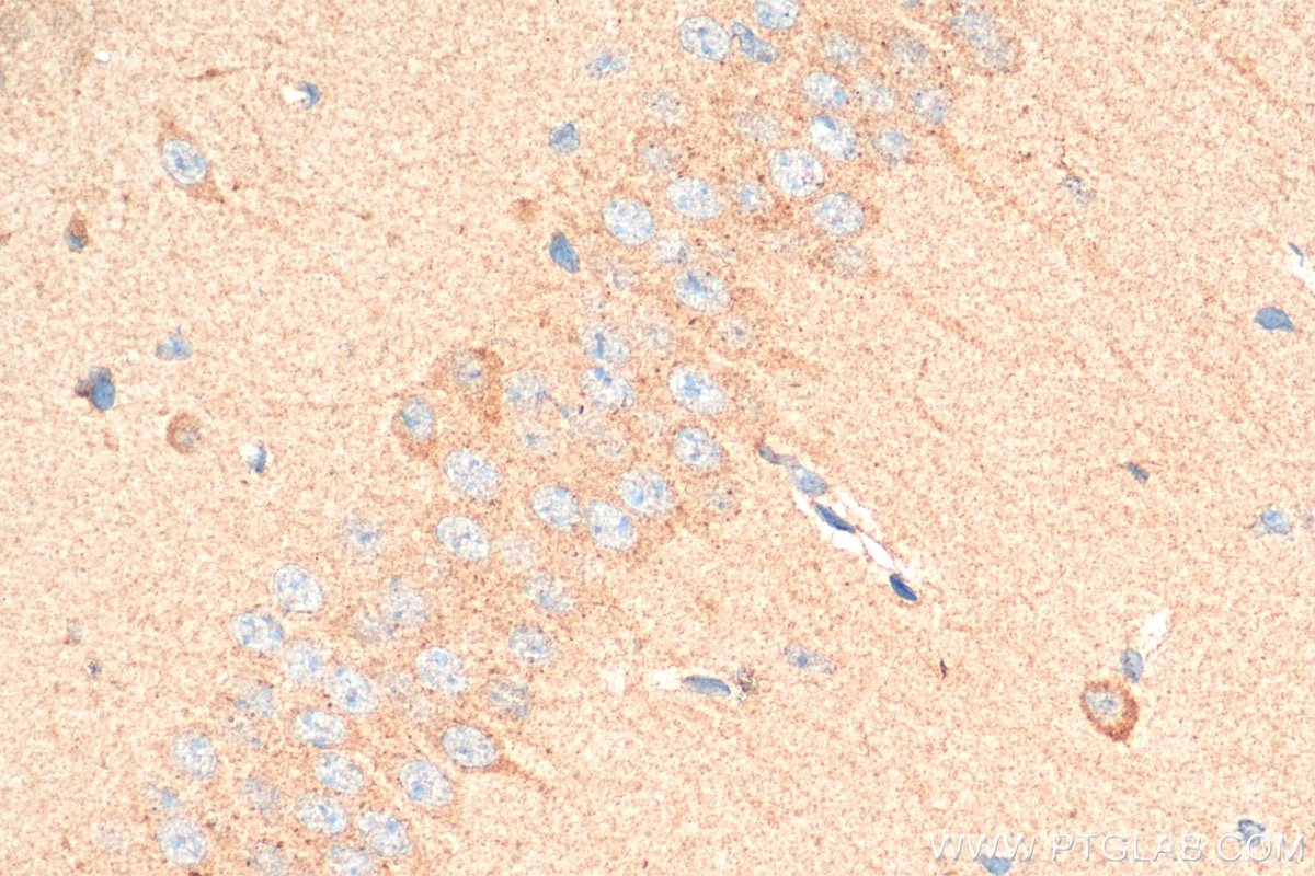 Immunohistochemistry (IHC) staining of mouse brain tissue using P62,SQSTM1 Polyclonal antibody (18420-1-AP)