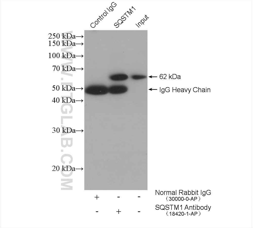 Immunoprecipitation (IP) experiment of HEK-293 cells using P62,SQSTM1 Polyclonal antibody (18420-1-AP)