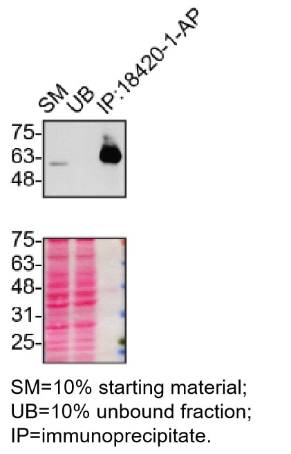 Immunoprecipitation (IP) experiment of U2OS cells using P62,SQSTM1 Polyclonal antibody (18420-1-AP)
