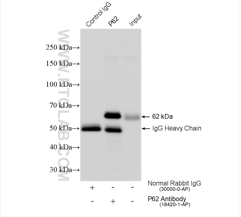 Immunoprecipitation (IP) experiment of HepG2 cells using P62,SQSTM1 Polyclonal antibody (18420-1-AP)