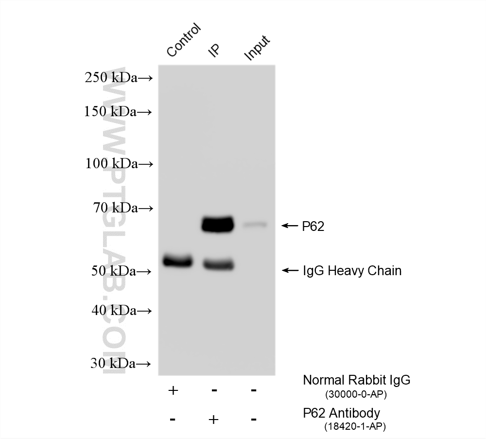 Immunoprecipitation (IP) experiment of HepG2 cells using P62/SQSTM1 Polyclonal antibody (18420-1-AP)