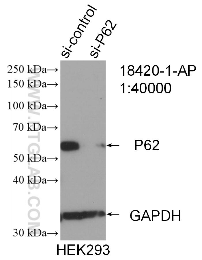Western Blot (WB) analysis of HEK-293 cells using P62,SQSTM1 Polyclonal antibody (18420-1-AP)