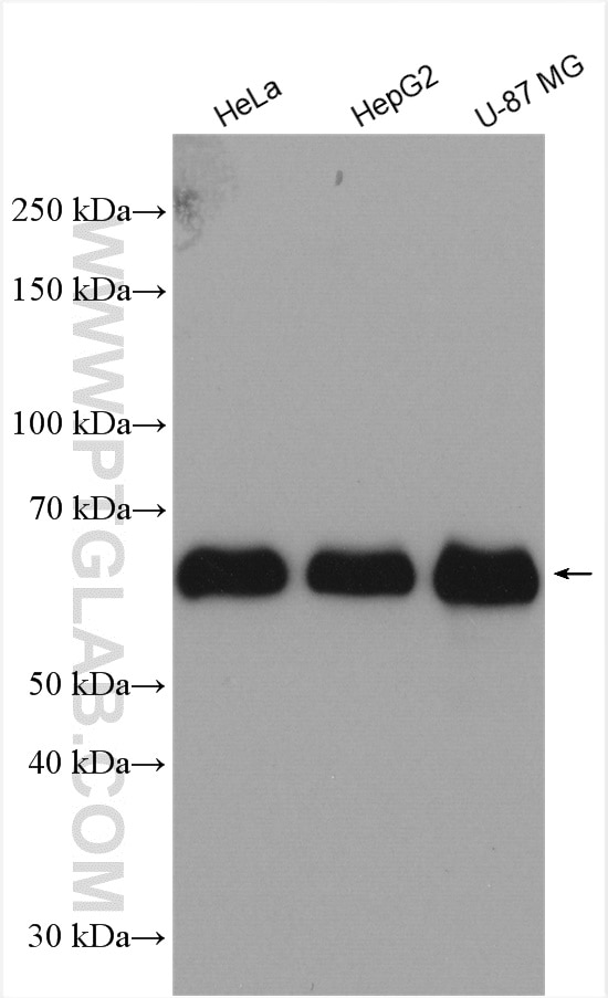 Western Blot (WB) analysis of various lysates using P62,SQSTM1 Polyclonal antibody (18420-1-AP)