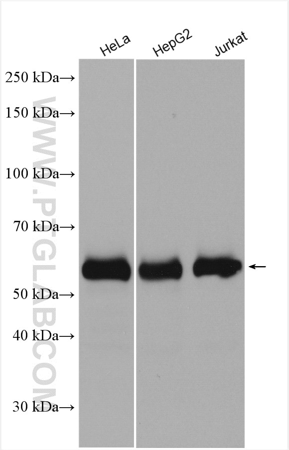 Western Blot (WB) analysis of various lysates using P62,SQSTM1 Polyclonal antibody (18420-1-AP)