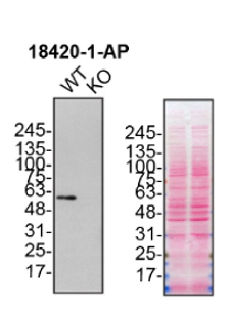 WB analysis of U2OS using 18420-1-AP