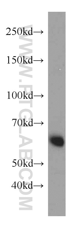 P62,SQSTM1 Polyclonal antibody