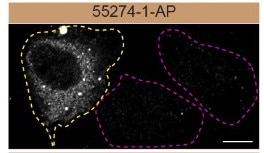 Immunofluorescence (IF) / fluorescent staining of U2OS cells using P62/SQSTM1 Polyclonal antibody (55274-1-AP)
