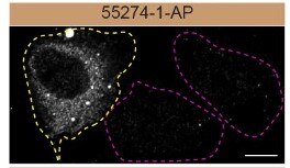 Immunofluorescence (IF) / fluorescent staining of U2OS cells using P62/SQSTM1 Polyclonal antibody (55274-1-AP)