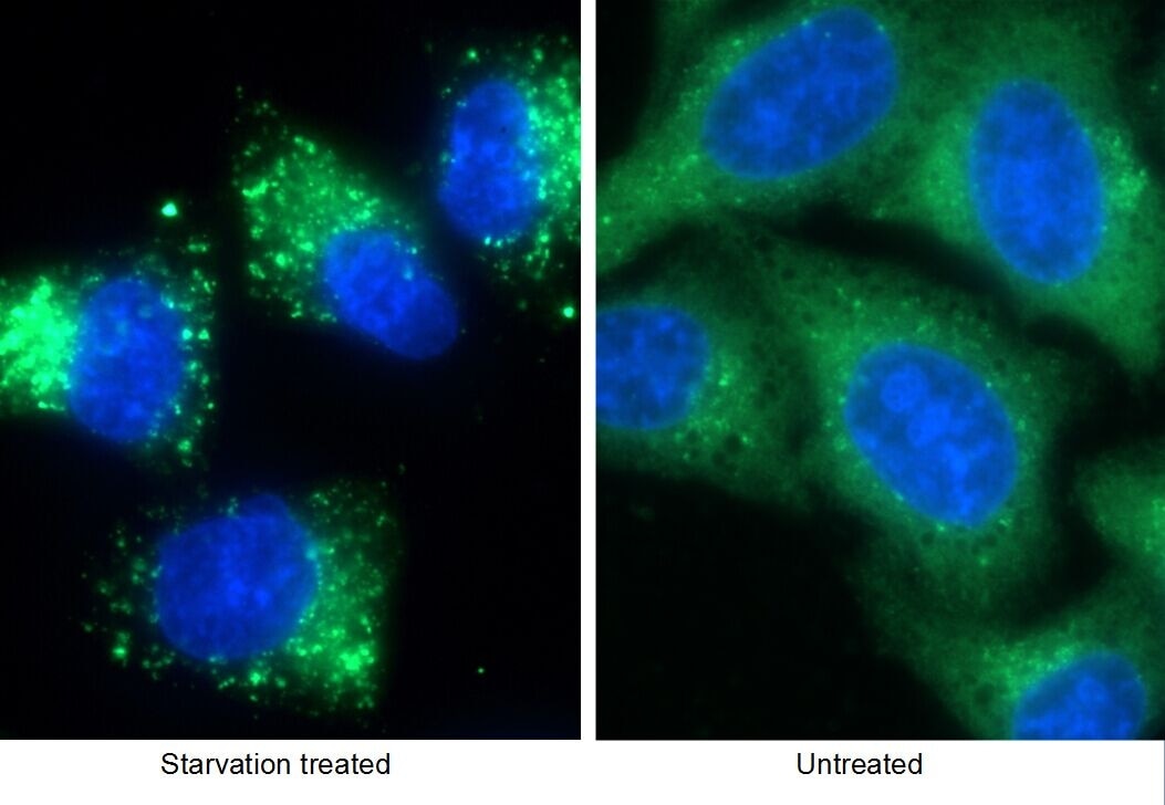 Immunofluorescence (IF) / fluorescent staining of HepG2 cells using P62/SQSTM1 Polyclonal antibody (55274-1-AP)