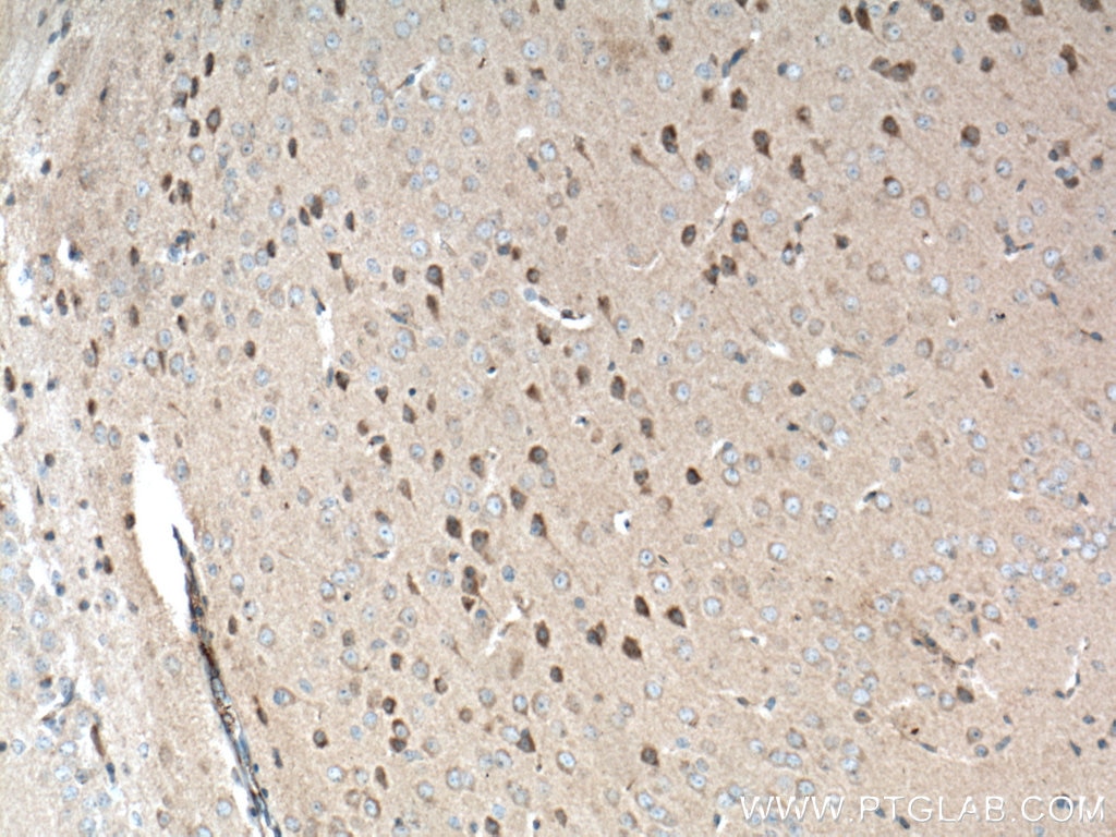 Immunohistochemistry (IHC) staining of mouse brain tissue using P62/SQSTM1 Polyclonal antibody (55274-1-AP)