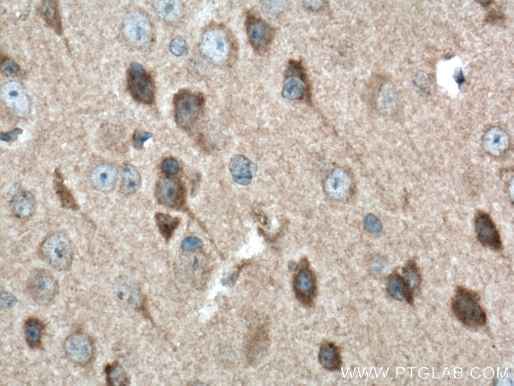 Immunohistochemistry (IHC) staining of mouse brain tissue using P62/SQSTM1 Polyclonal antibody (55274-1-AP)