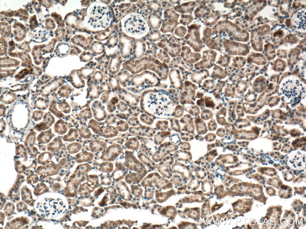 Immunohistochemistry (IHC) staining of mouse kidney tissue using P62/SQSTM1 Polyclonal antibody (55274-1-AP)