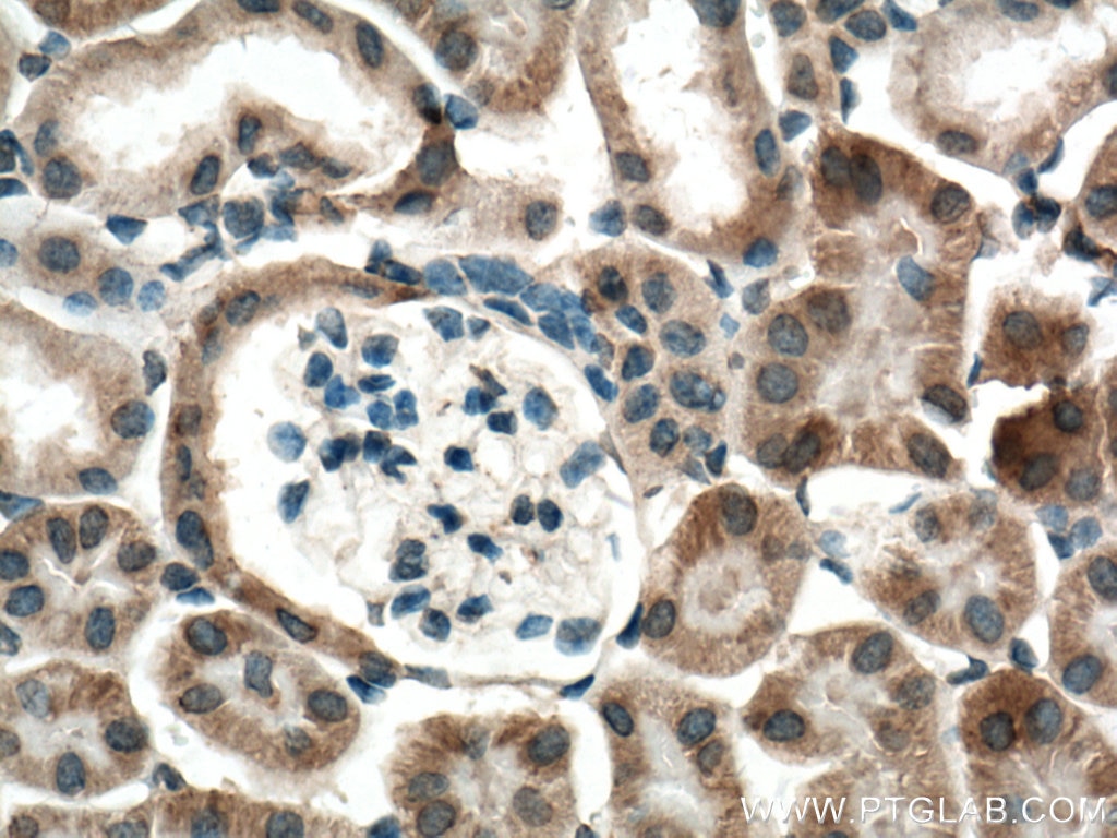Immunohistochemistry (IHC) staining of mouse kidney tissue using P62/SQSTM1 Polyclonal antibody (55274-1-AP)