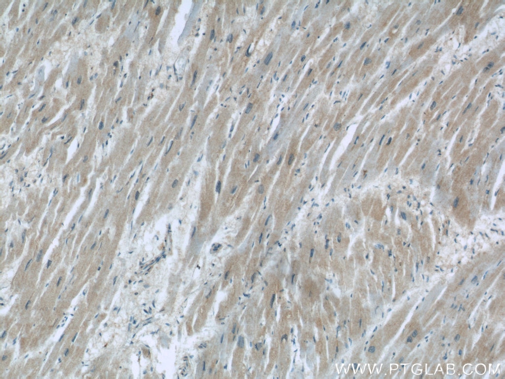 Immunohistochemistry (IHC) staining of human heart tissue using P62/SQSTM1 Polyclonal antibody (55274-1-AP)