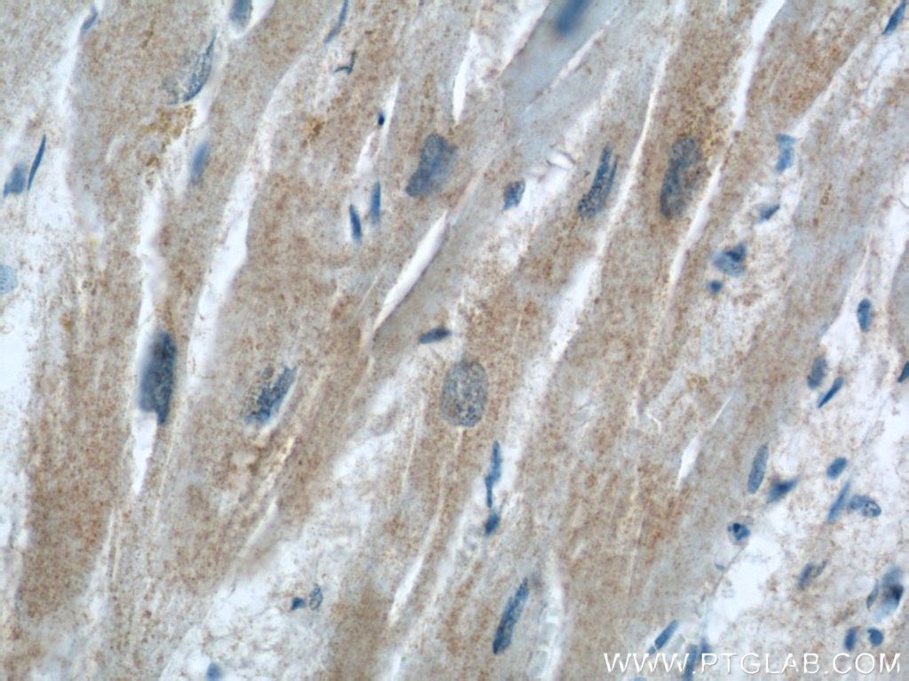 Immunohistochemistry (IHC) staining of human heart tissue using P62/SQSTM1 Polyclonal antibody (55274-1-AP)