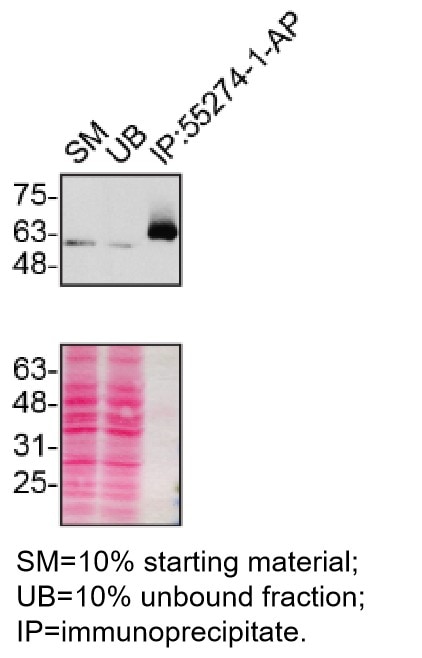 Immunoprecipitation (IP) experiment of U2OS cells using P62/SQSTM1 Polyclonal antibody (55274-1-AP)