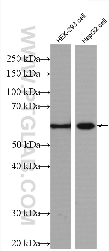 Western Blot (WB) analysis of various lysates using P62/SQSTM1 Polyclonal antibody (55274-1-AP)