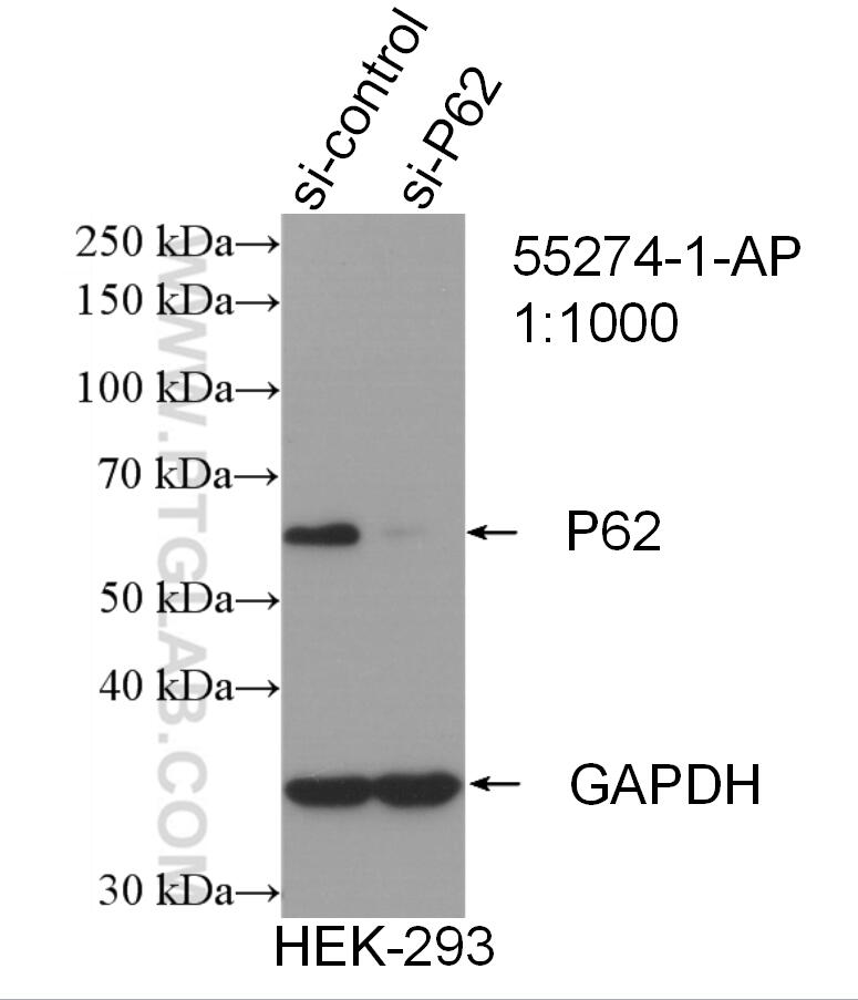 Western Blot (WB) analysis of HEK-293 cells using P62/SQSTM1 Polyclonal antibody (55274-1-AP)