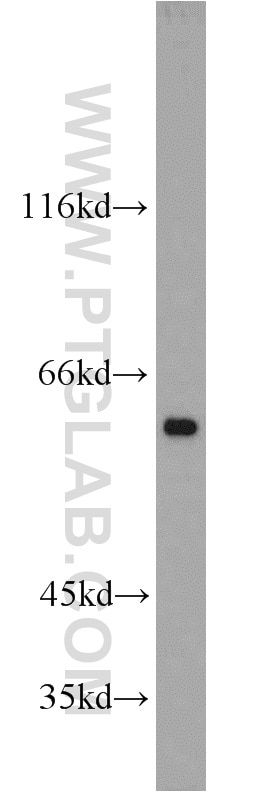 Western Blot (WB) analysis of MCF-7 cells using P62/SQSTM1 Polyclonal antibody (55274-1-AP)