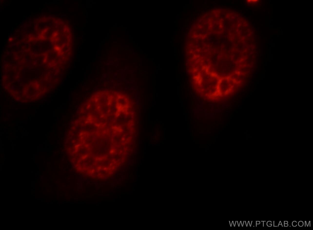 Immunofluorescence (IF) / fluorescent staining of HepG2 cells using SR140 Polyclonal antibody (21399-1-AP)