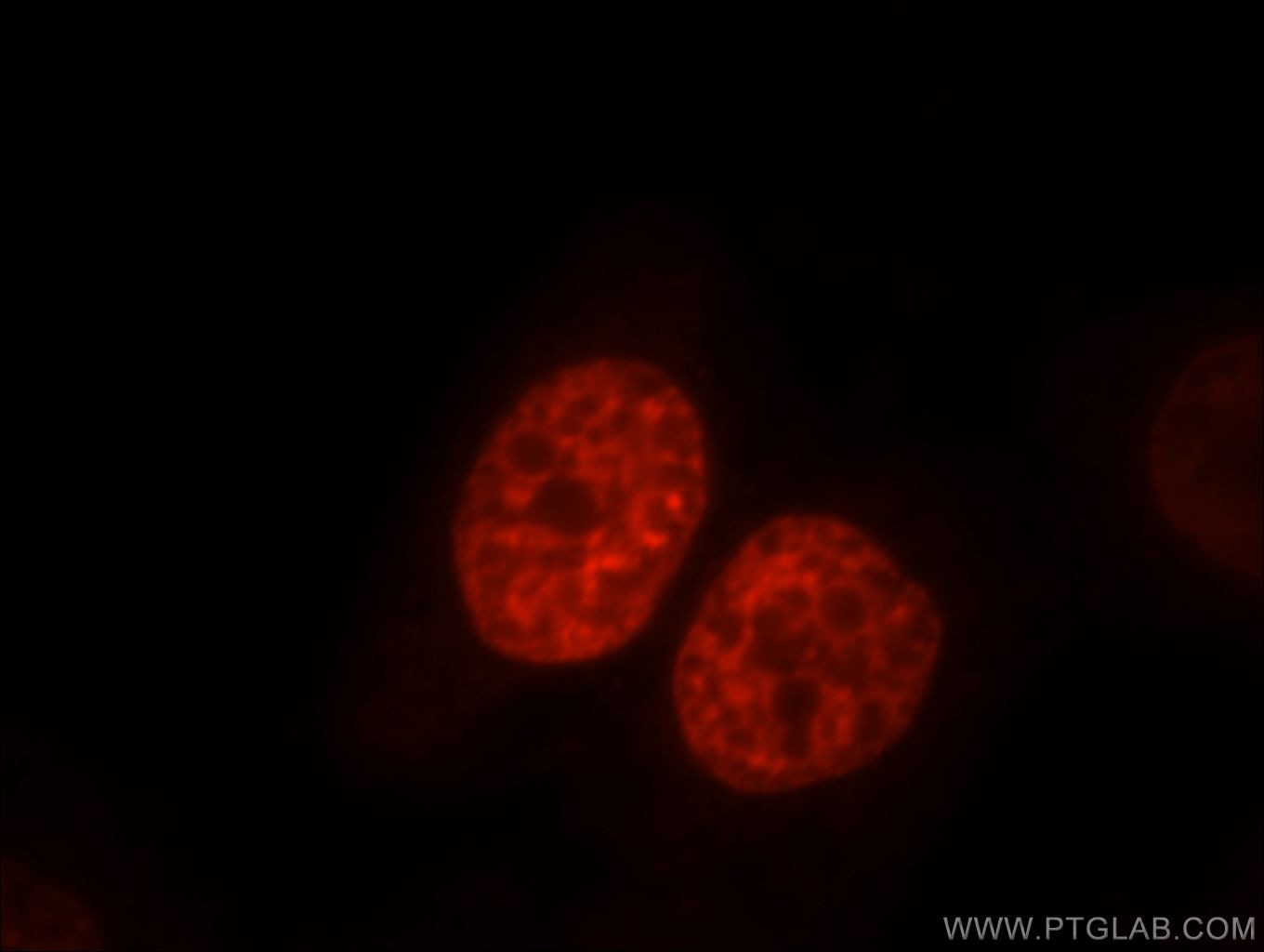 Immunofluorescence (IF) / fluorescent staining of HeLa cells using SR140 Polyclonal antibody (21399-1-AP)