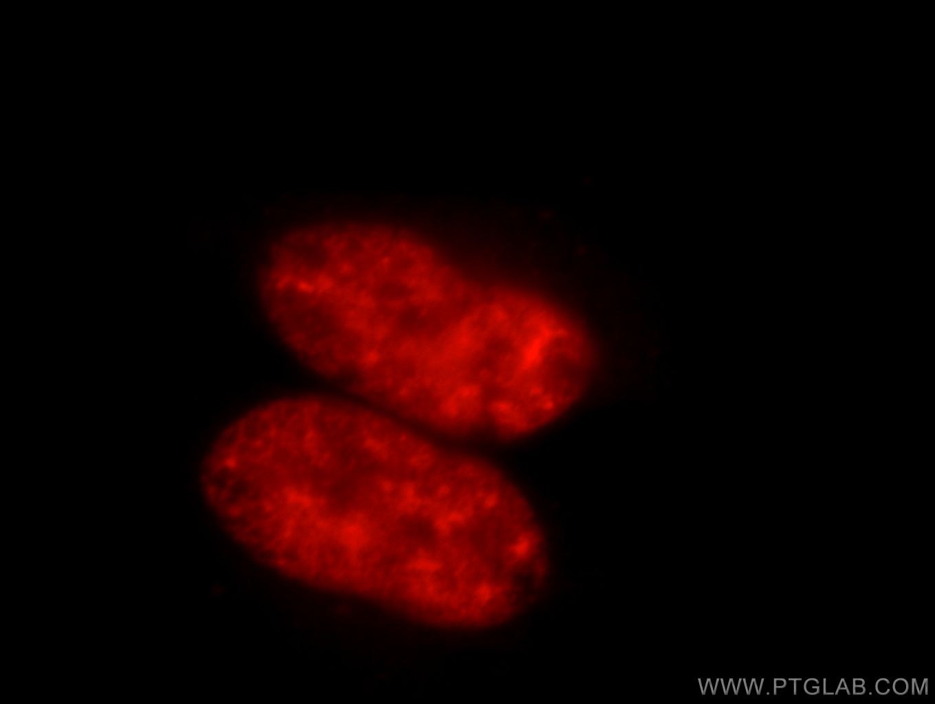 Immunofluorescence (IF) / fluorescent staining of HEK-293 cells using SR140 Polyclonal antibody (21399-1-AP)