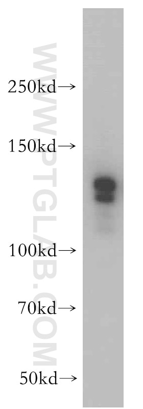 Western Blot (WB) analysis of human brain tissue using SR140 Polyclonal antibody (21399-1-AP)